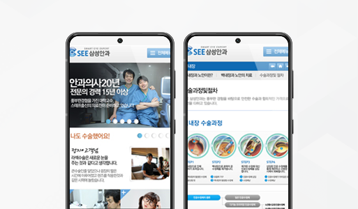 삼성안과